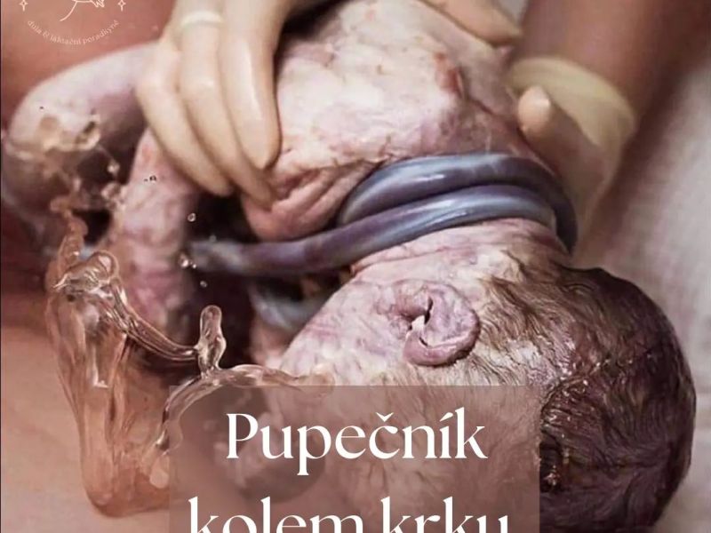 Pupečník kolem krku